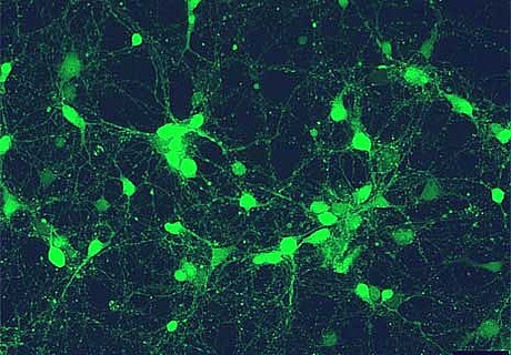 Central adipokine effects